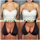 💕LAST DAY SALE ONLY ￡7.99!!💕OUFALI Lift Inserts for Bras – Lightly Padded, Double-Sided Adhesive👙 Reusable, Washable • Natural Lift • Seamless Under Clothing ✨