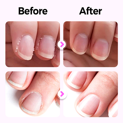 3-in-1 Nail Care Pen