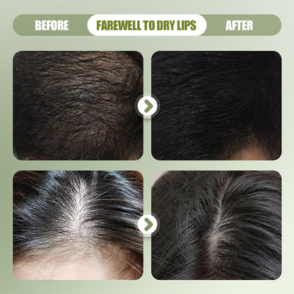 🔥Hot Sale Buy 2 Get 1 Free🔥Natural Shampoo Bar For Strengthening Hair